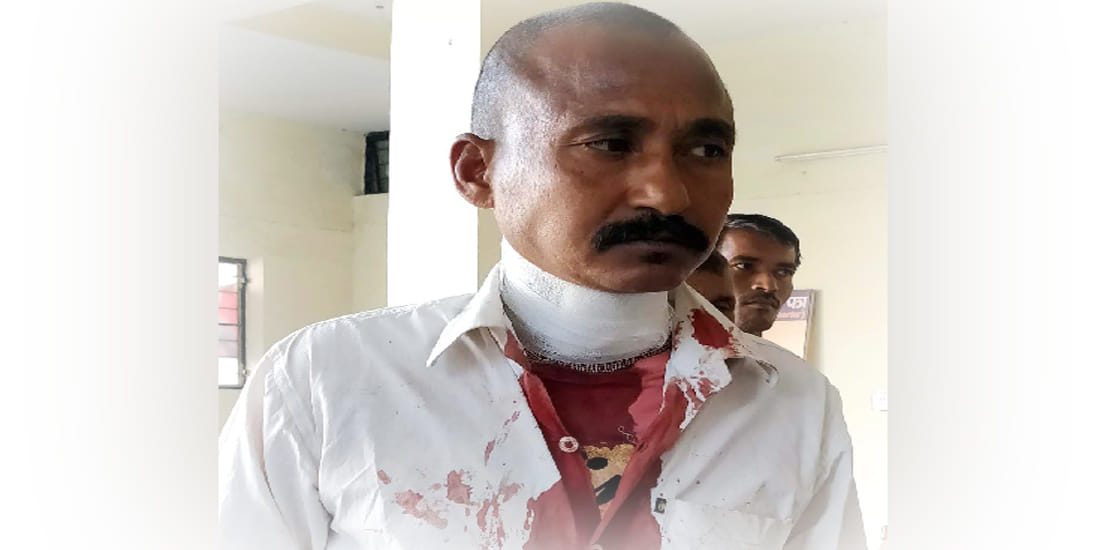 barber cut neck while shaving