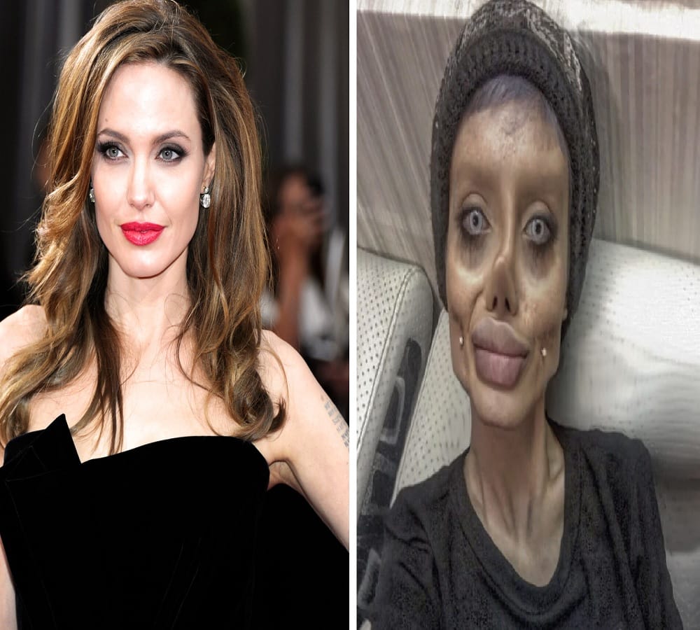 Desire to look like Angelina Jolie this girl got fifty surgeries 