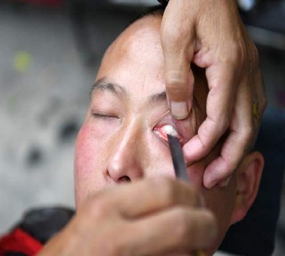 This Chinese barber shaves eye balls give better vision