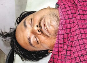 Bullet shot from a history sheeter pistol, injured Mistry