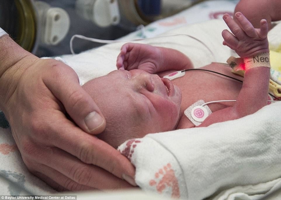 First baby born from a uterus transplant in the US