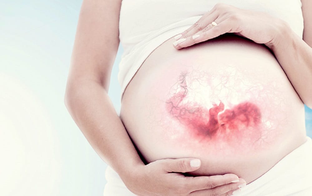 Stone Baby Found In Women Abdomen At Nagpur 15 Years After Abortion