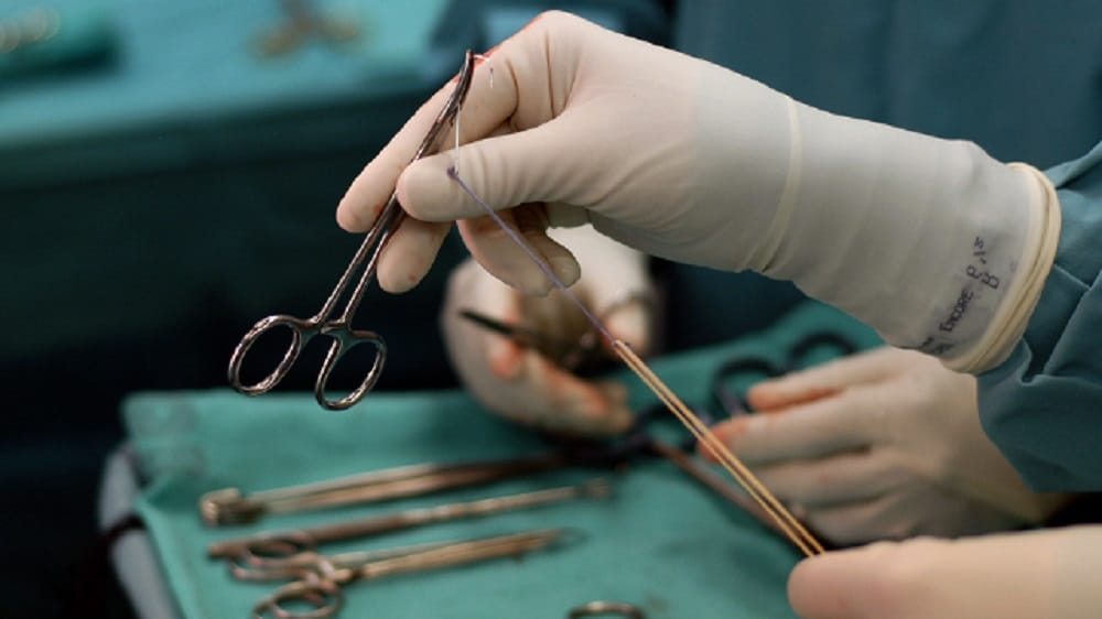 Stone Baby Found In Women Abdomen At Nagpur 15 Years After Abortion