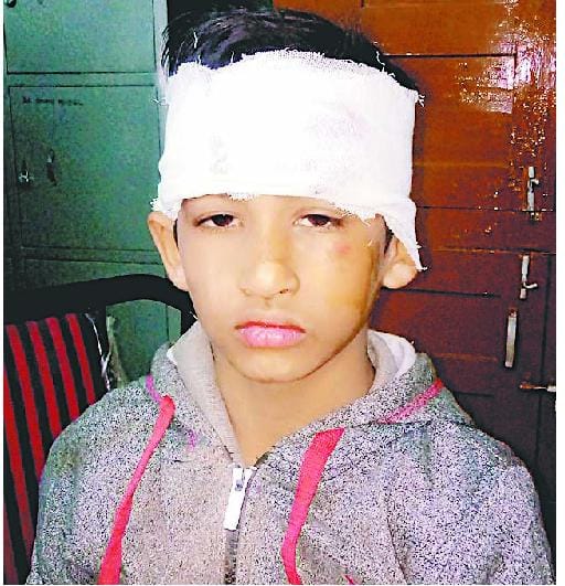 धाम खाकर लौट रहे लोगों से भरी पिकअप पलटी, दो बच्चों समेत 8 घायल