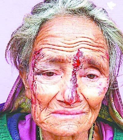 Leopard injured 70-year-old woman