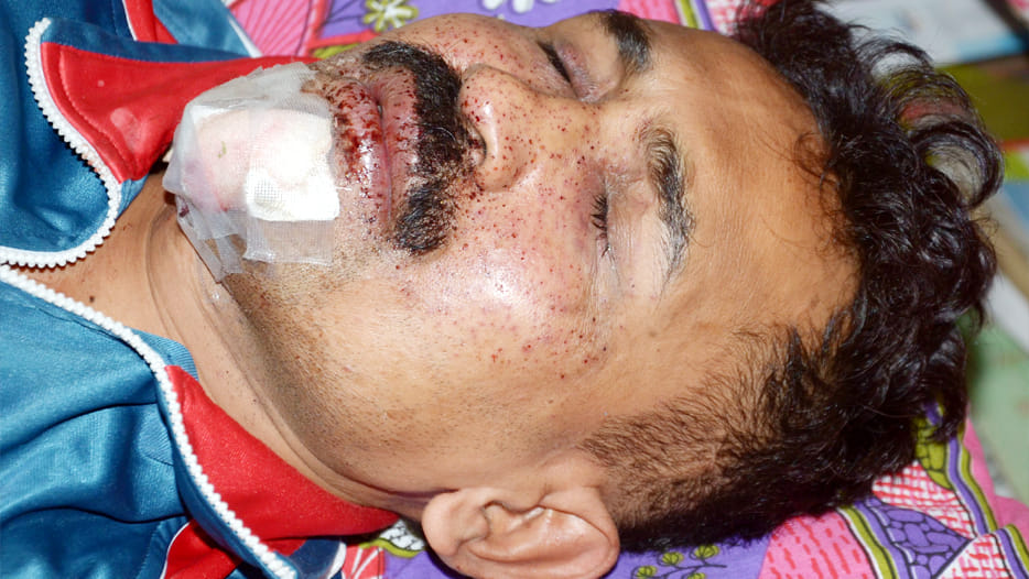 criminal attacked on police in kanpur