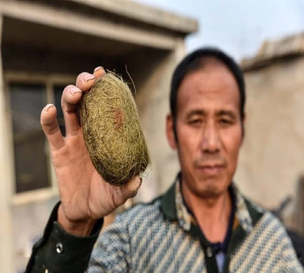 A man found Millionaire making stone from pig stomach at china