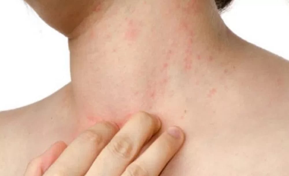 Aloe Vera side effects you should know