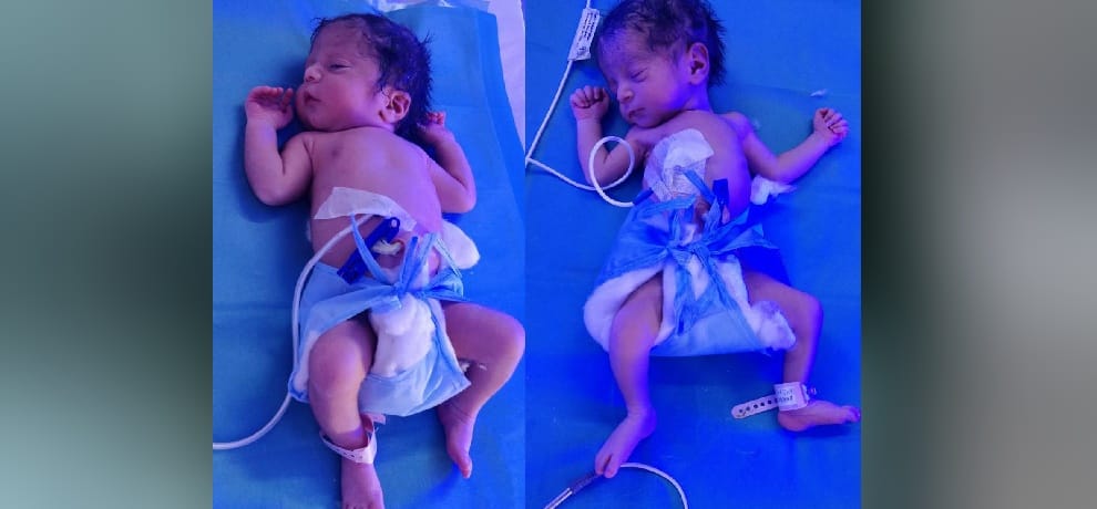 fifty seven years old lady gave birth to two babies