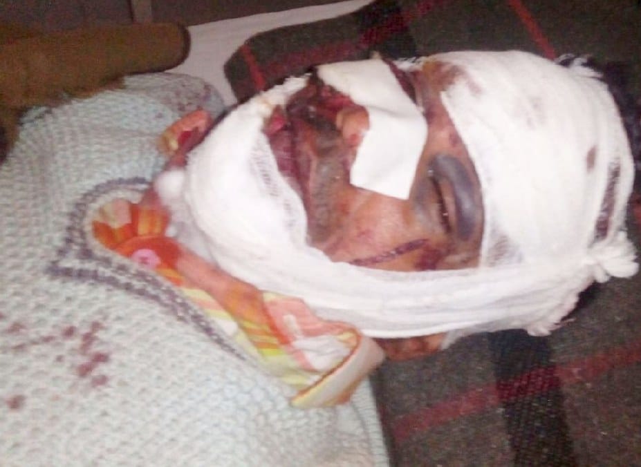 National highway clamped with tempo DCM, seven wounded