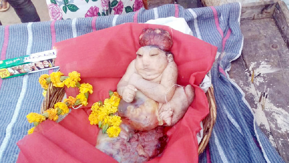bizarre child born in kanpur
