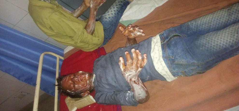 five children burnt in Fire burst from balloons in the program of Bihar Governor