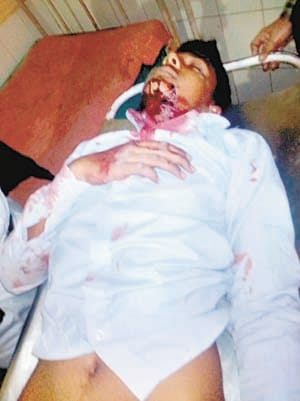 attack with knief on 11th student
