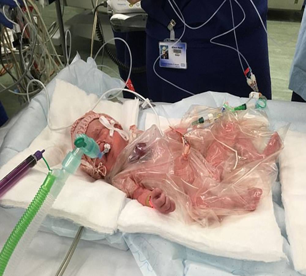 The New Born Baby Heart was beating out of the Chest