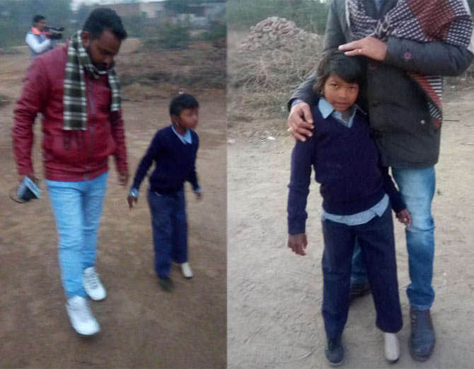 brave daughter of india, 6 years old mansa girl meera got artificial leg