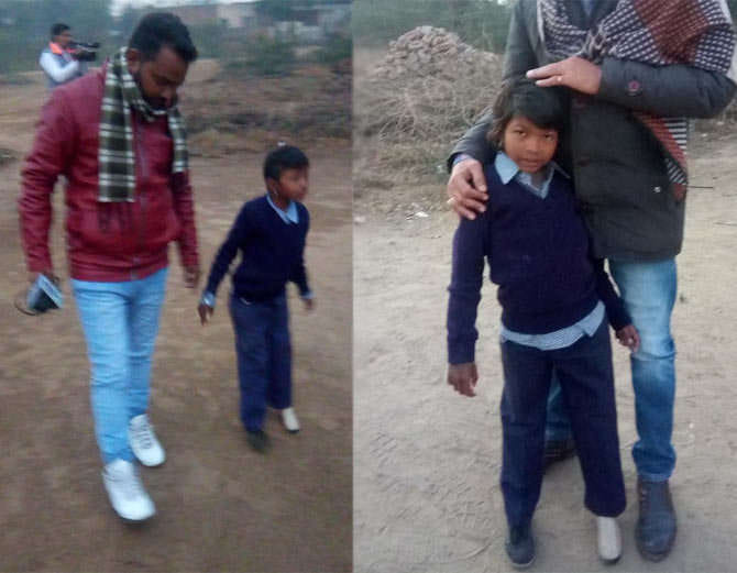 brave daughter of india, 6 years old mansa girl meera got artificial leg