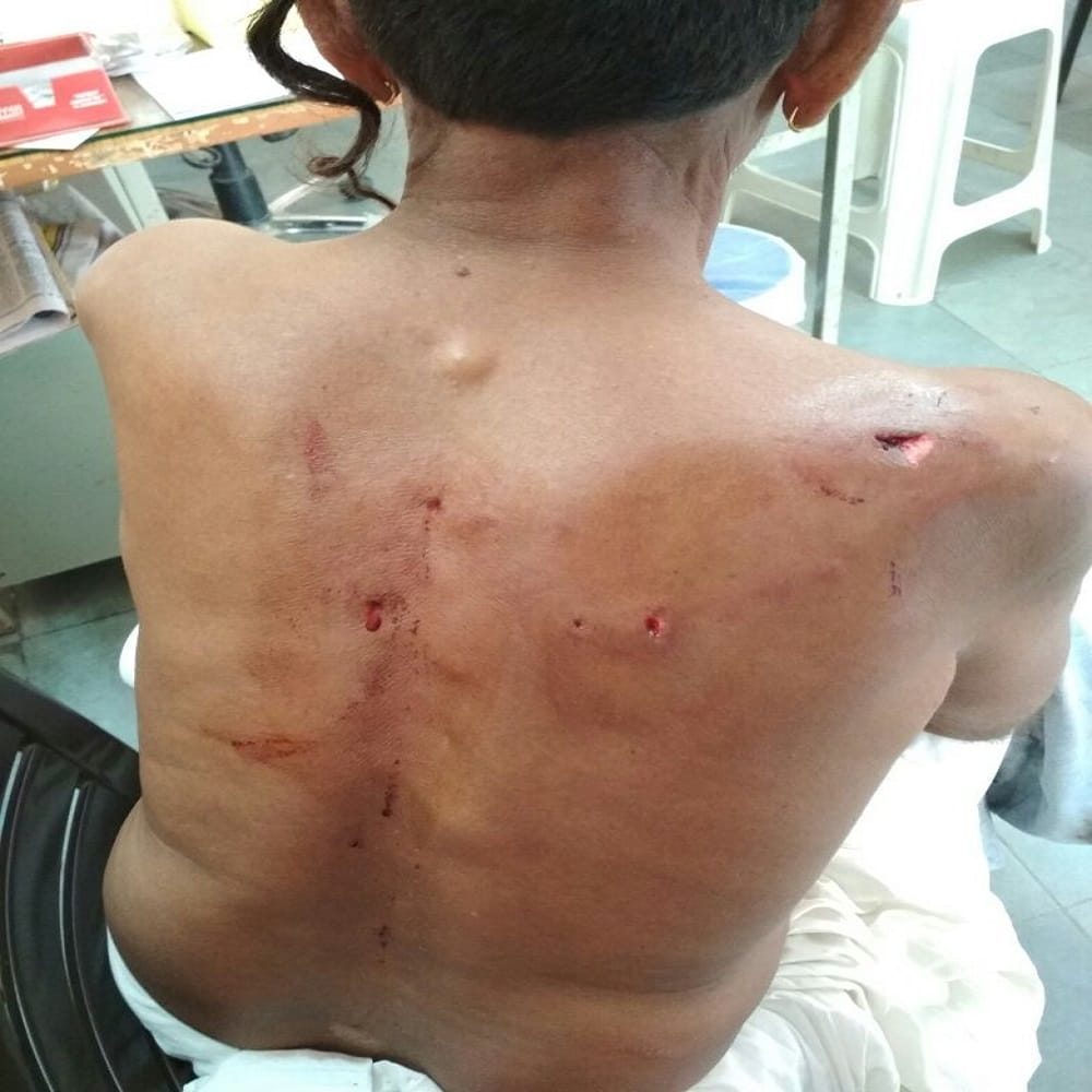 rajasthan barmer forest department remains clue less about panther who attacked 5 people in samdari 