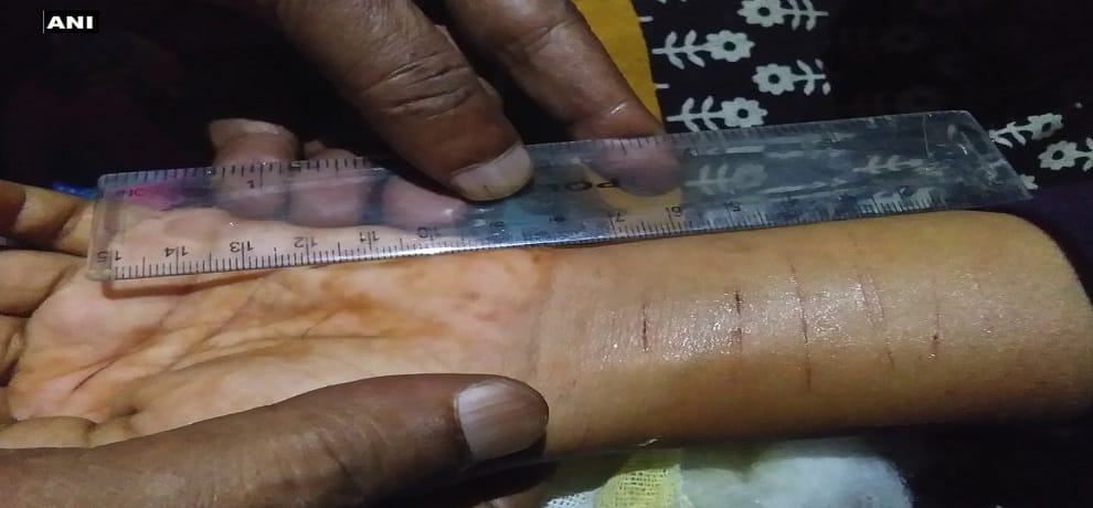 young man attacked a girl with a blade in Honnavar of Karnataka 