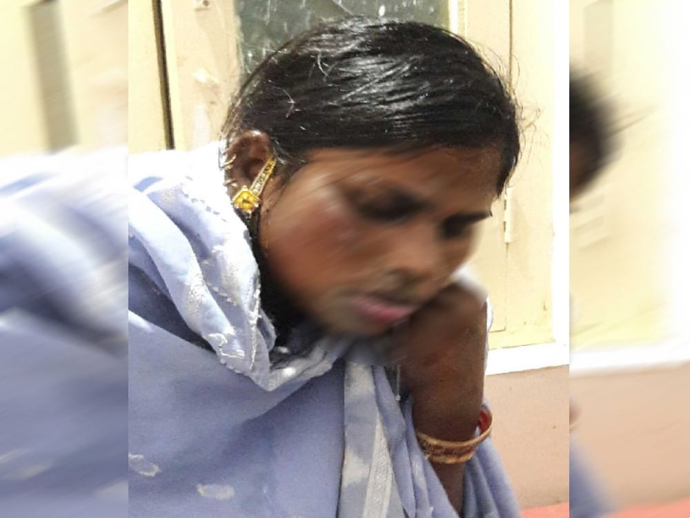 acid attack on a woman in pithoragarh