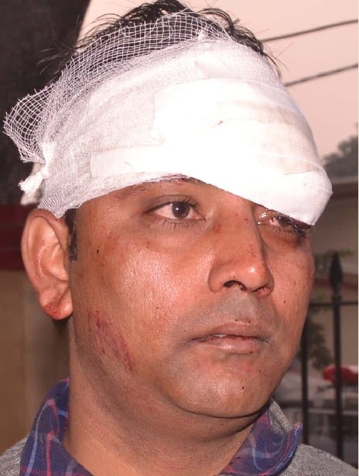 किराना व्यापारी को तमंचे की बट से पीटकर किया लहूलुहान