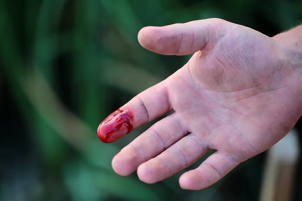 This Is Why Blood Platelet Is Important For Mammal 