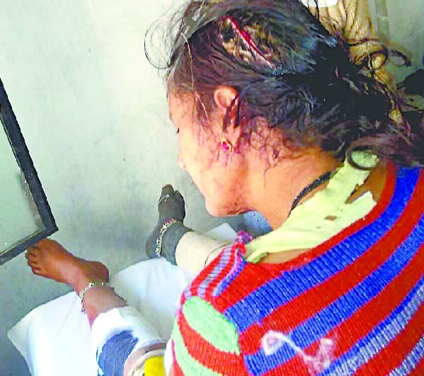Woman injured in attack of bear