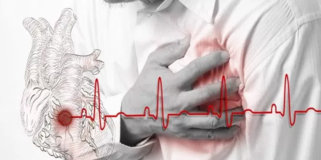 due to cold heart attack cases are rising