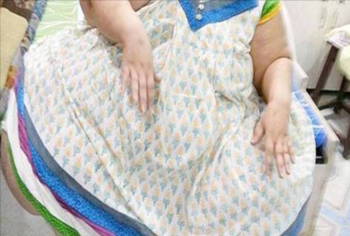 A Man crushed to death by his 128 kg wife 