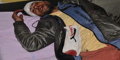 Death in a single brother accident