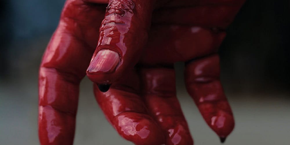youth lost his claw after his hand accidentally came into fodder machine 