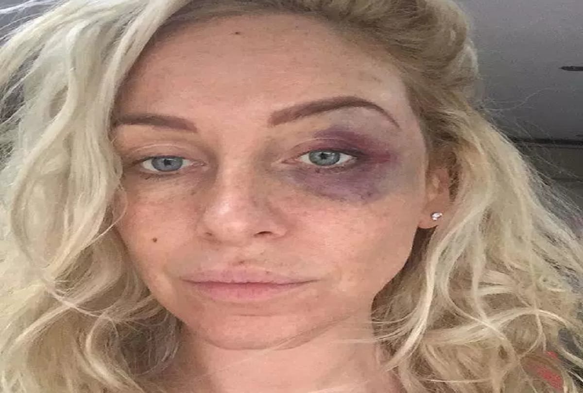American reality show Big Brother winner Josie Gibson assaulted by a man in car