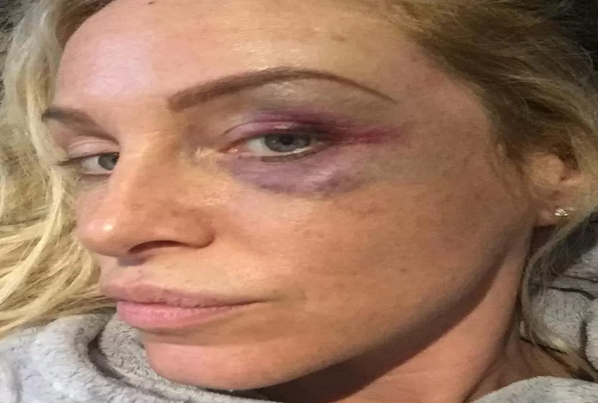 American reality show Big Brother winner Josie Gibson assaulted by a man in car