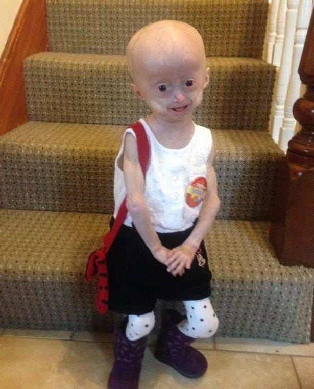 A girl who started period in age of eight years