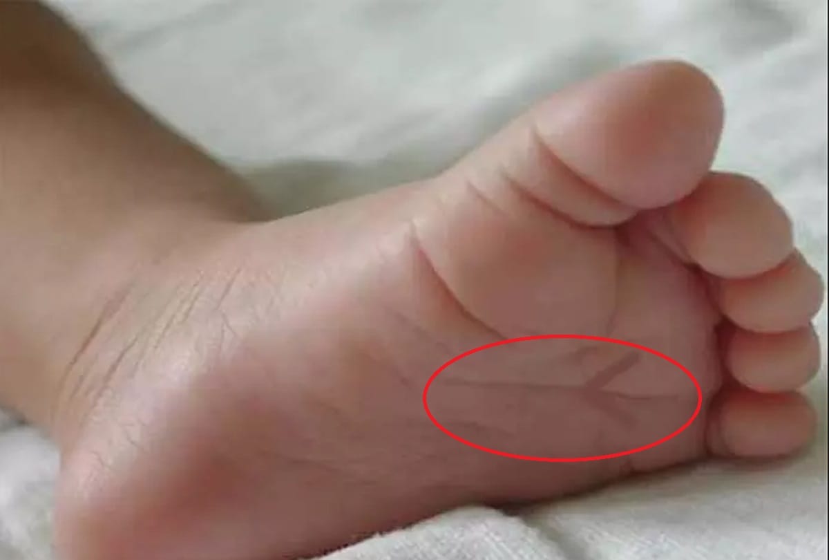 these two marks of your feet predict your wealth 