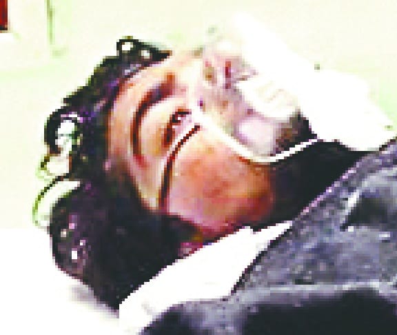 pootha me yuvak ko goli maari