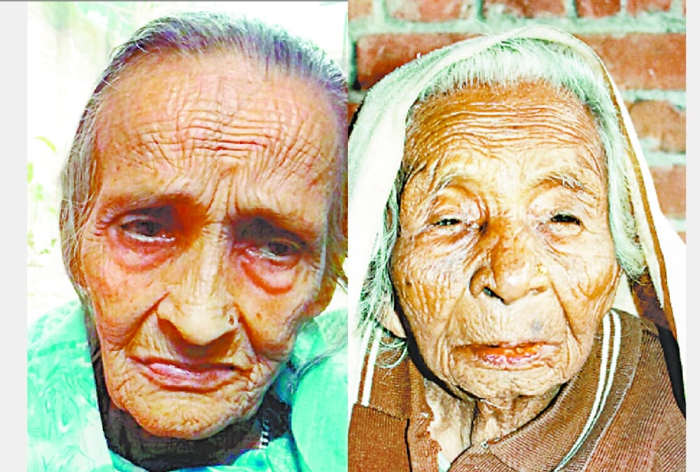 Doctors surprised on hair of old ladies being black.