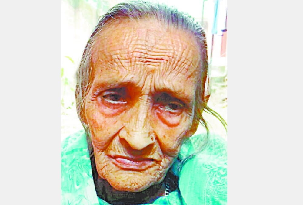 Doctors surprised on hair of old ladies being black.