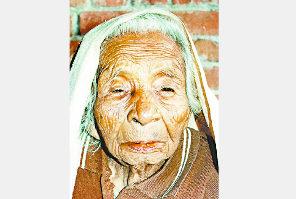 Doctors surprised on hair of old ladies being black.