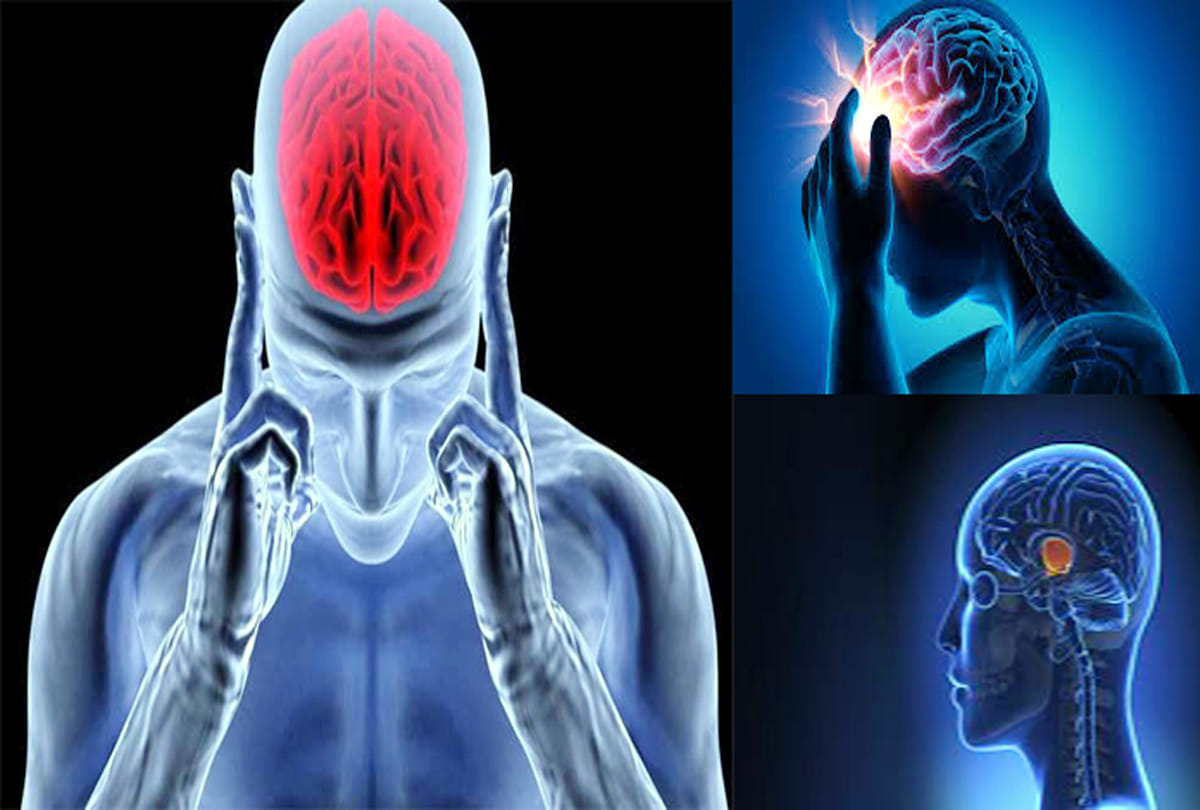brain stroke and paralysis risk factors before 40 age know bad habits that cause stroke