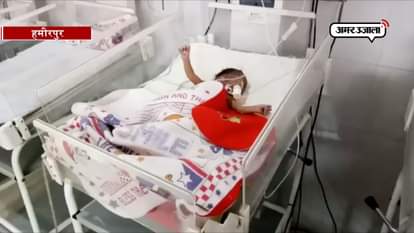 Doctors save the life of new born baby from Jaundice