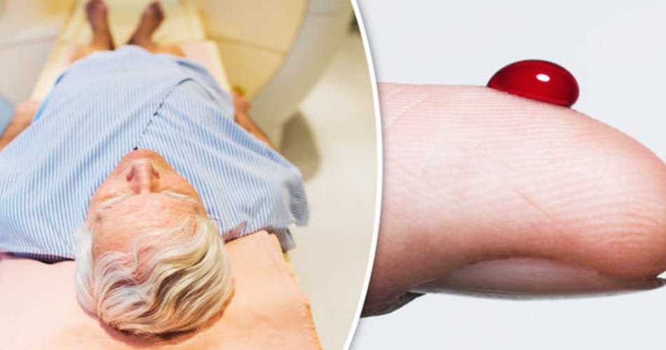 Prostate Cancer symptoms told by doctor