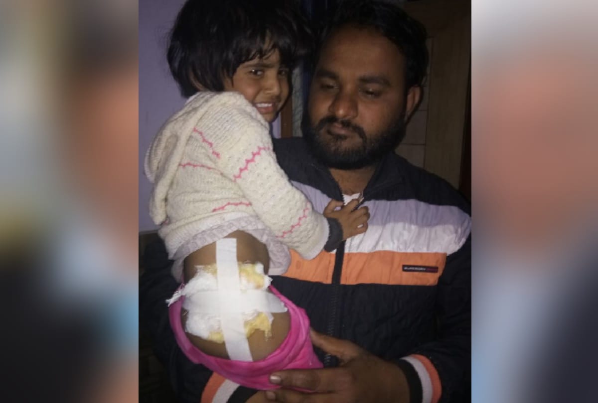 dog bite two children in noida