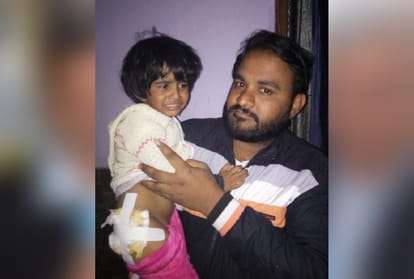 dog bite two children in noida