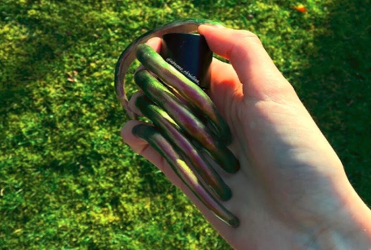 Girl has not cut her nails from three years