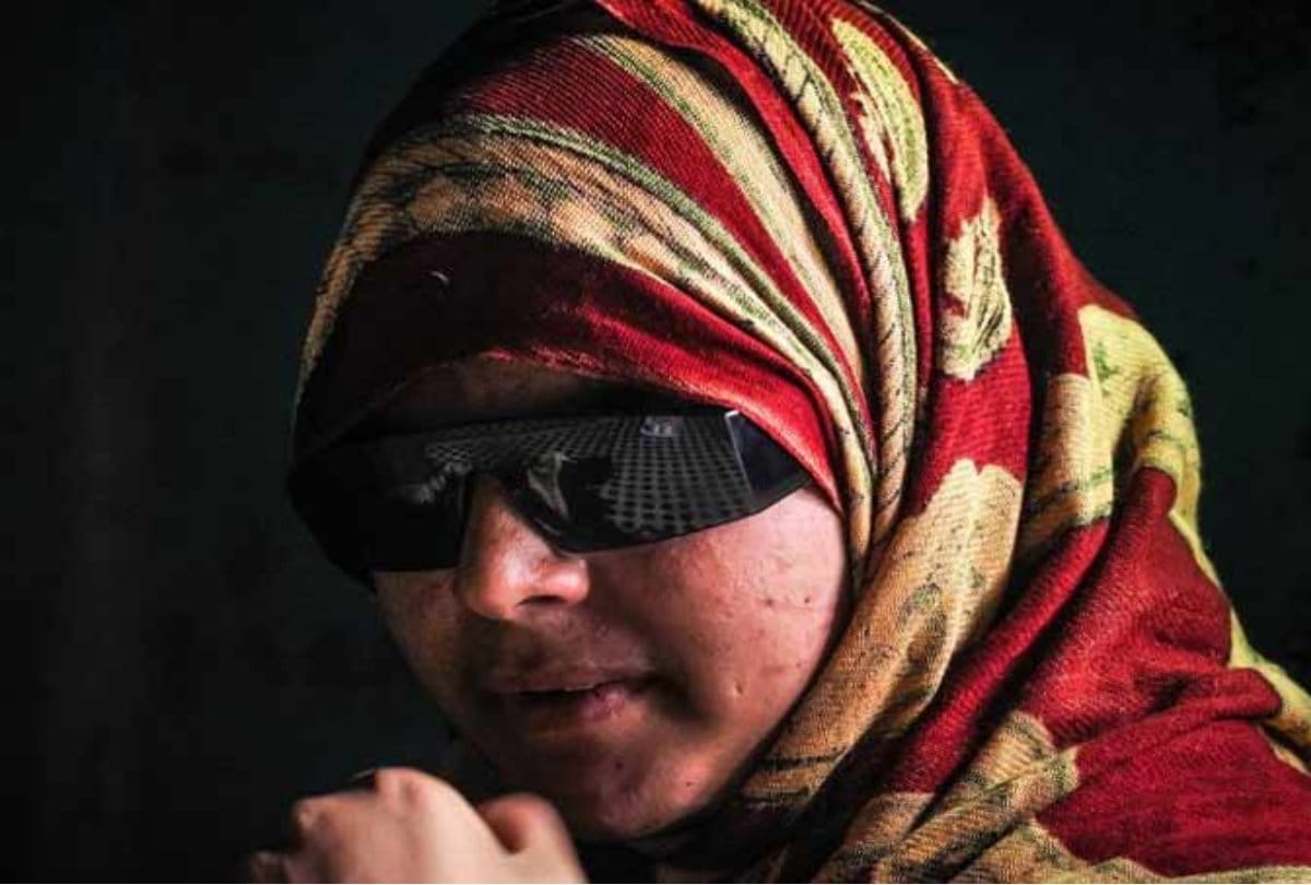 victim of pallet gun use in kashmir insha pass 10th exam