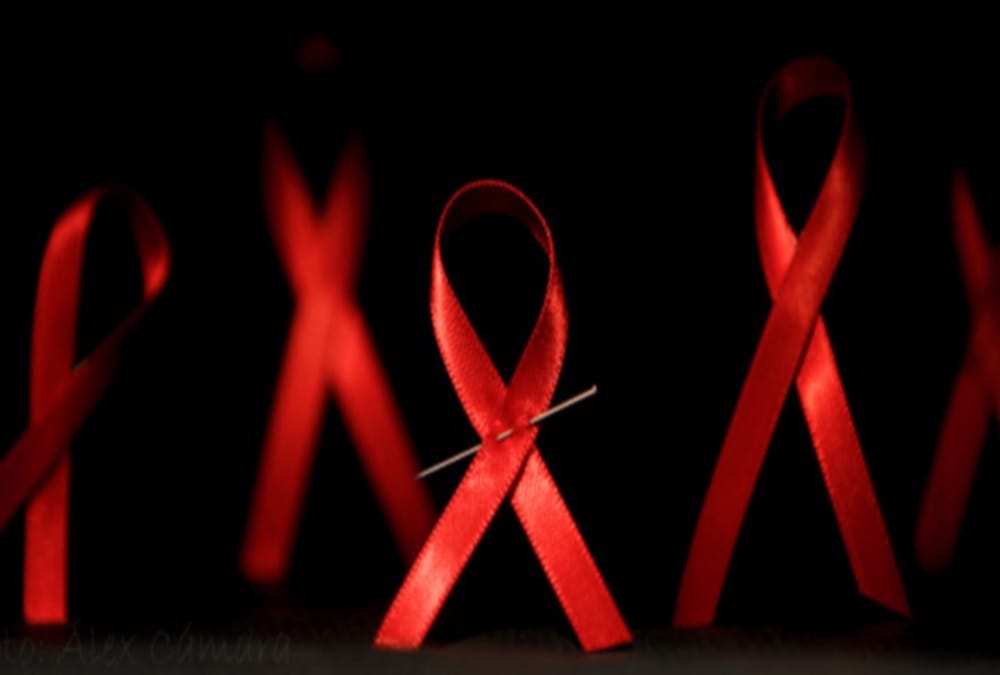 after dialysis patient is hiv positive