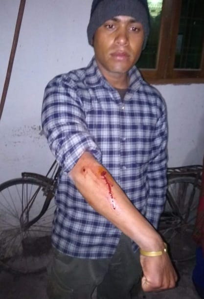 ravenous leopard attack on boy in bathroom in dehradun