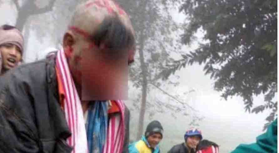 Theft accused beaten by public in azamgarh