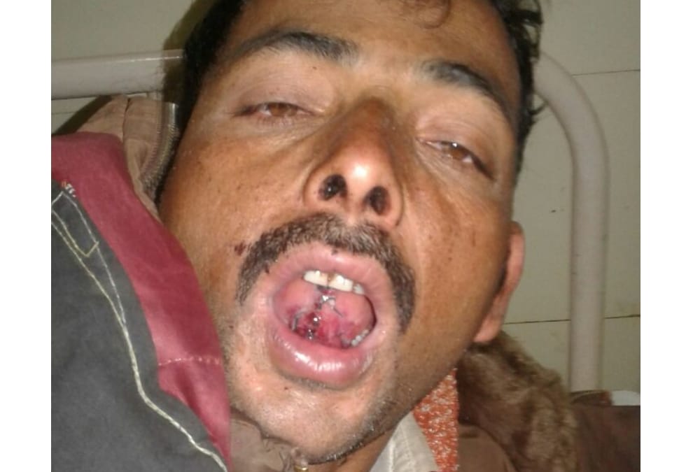 goons cut tounge of an eye witness of a murder.