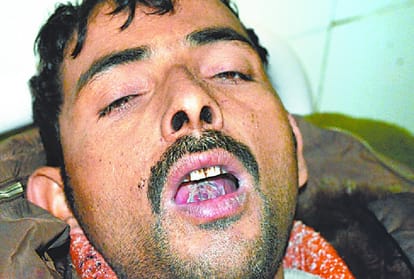 goons cut tounge of an eye witness of a murder.
